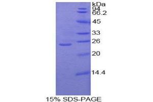 SDS-PAGE (SDS) image for Protein Kinase C, zeta (PRKCZ) (AA 404-591) protein (His tag) (ABIN1879240) (PKC zeta Protein (AA 404-591) (His tag))