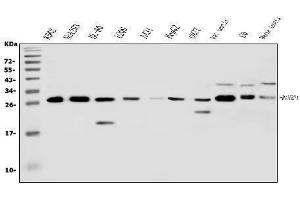 Western blot analysis of RanBP1 using anti-RanBP1 antibody (ABIN5518868). (RANBP1 antibody  (AA 2-201))