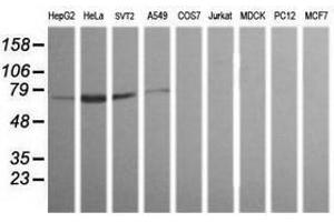 Image no. 1 for anti-ERG, ETS transcription factor (ERG) antibody (ABIN1498080) (ERG antibody)