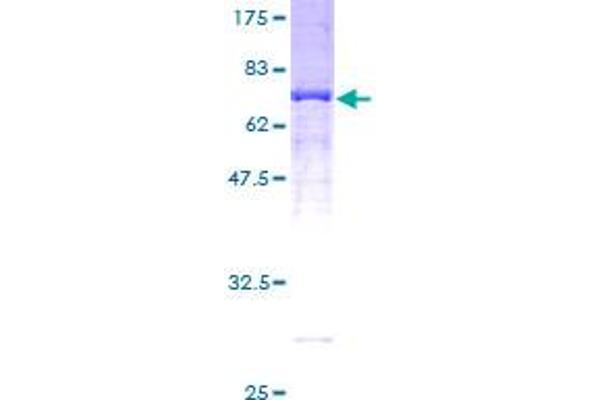 SERPINA3 Protein (AA 25-423) (GST tag)