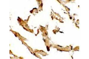 Immunohistochemical anyalysis of human lung tissue with WDR18 polyclonal antibody  at 2. (WDR18 antibody  (C-Term))