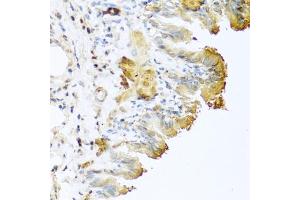 Immunohistochemistry of paraffin-embedded mouse lung using Vitronectin antibody (ABIN3022357, ABIN3022358, ABIN3022359 and ABIN6218758) at dilution of 1:100 (40x lens). (Vitronectin antibody  (AA 364-478))