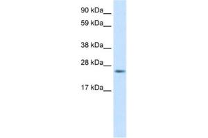 Western Blotting (WB) image for anti-Fas (TNFRSF6)-Associated Via Death Domain (FADD) antibody (ABIN2463651) (FADD antibody)