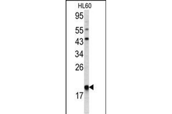 ARPC3 antibody  (C-Term)