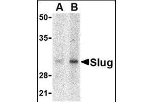 Western blot analysis of Slug in human kidney cell lysate with this product at in (A) 1 and (B) 2 μg/ml. (SLUG antibody  (Center))
