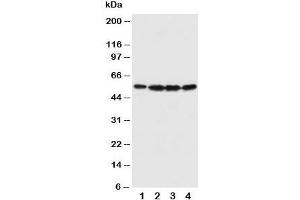 Western blot testing of Fascin antibody and Lane 1:  U87;  2: A549;  3: MCF-7;  4: HT1080 cell lysate
