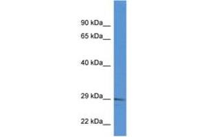 Image no. 1 for anti-RAB2B, Member RAS Oncogene Family (RAB2B) (C-Term) antibody (ABIN6746885) (RAB2B antibody  (C-Term))