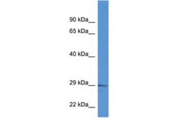 RAB2B antibody  (C-Term)