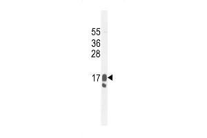 Western blot analysis in MDA-MB231 cell line lysates (35ug/lane). (PIP antibody  (C-Term))