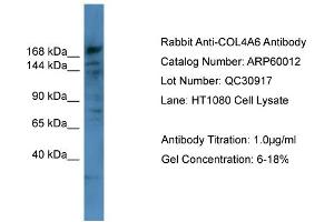 WB Suggested Anti-COL4A6  Antibody Titration: 0. (COL4a6 antibody  (Middle Region))