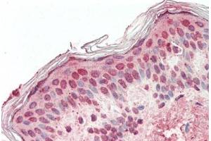 Human, Skin: Formalin-Fixed Paraffin-Embedded (FFPE) (PBX2 antibody  (N-Term))