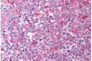 Image no. 2 for anti-Chemokine (C-C Motif) Ligand 7 (CCL7) (AA 30-79) antibody (ABIN6736363) (CCL7 antibody  (AA 30-79))