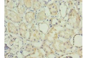 Immunohistochemistry of paraffin-embedded human kidney tissue using ABIN7142271 at dilution of 1:100 (MRPS36 antibody  (AA 1-103))