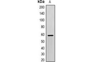 Western blot analysis of SCP2 expression in HepG2 (A) whole cell lysates. (SCP2 antibody)