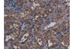 Detection of FTH in Porcine Kidney Tissue using Polyclonal Antibody to Ferritin, Heavy Polypeptide (FTH) (FTH1 antibody  (AA 1-181))