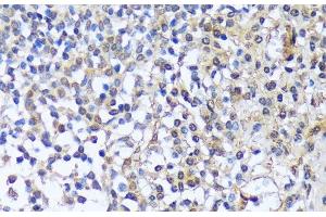 Immunohistochemistry of paraffin-embedded Human tonsil using A1CF Polyclonal Antibody at dilution of 1:100 (40x lens). (A1CF antibody)