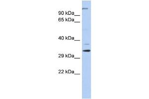 WB Suggested Anti-ARPC2 Antibody Titration: 0. (ARPC2 antibody  (N-Term))