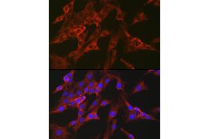 Immunofluorescence analysis of C6 cells using FBP1 Rabbit pAb (ABIN6130385, ABIN6140501, ABIN6140502 and ABIN6221054) at dilution of 1:100 (40x lens). (FBP1 antibody  (AA 1-338))