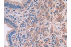 DAB staining on IHC-P; Samples: Mouse Uterus Tissue (MYLK2 antibody  (AA 330-548))