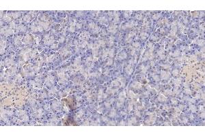 Detection of TF in Human Pancreas Tissue using Monoclonal Antibody to Tissue Factor (TF) (Tissue factor antibody  (AA 34-251))
