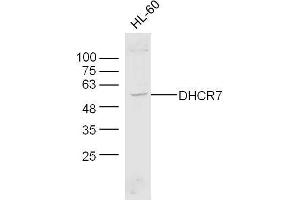 Human HL-60 cell lysates probed with Anti-DHCR7 Polyclonal Antibody, Unconjugated  at 1:300 overnight at 4˚C. (DHCR7 antibody  (AA 351-450))