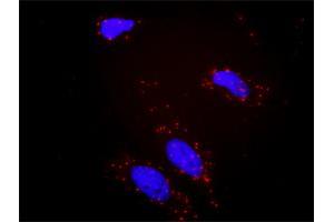 Proximity Ligation Analysis of protein-protein interactions between BCR and PIK3CG. (BCR antibody  (AA 1-1076))