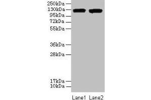 Western blot All lanes: ITGAL antibody at 8 μg/mL Lane 1: A549 whole cell lysate Lane 2: HepG2 whole cell lysate Secondary Goat polyclonal to rabbit IgG at 1/10000 dilution Predicted band size: 129, 135, 120 kDa Observed band size: 129 kDa