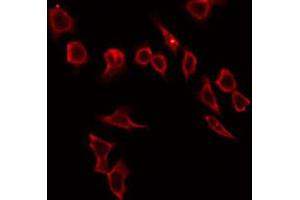 ABIN6272316 staining HeLa by IF/ICC. (HABP2 antibody  (Internal Region))