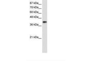 Image no. 1 for anti-Distal-Less Homeobox 3 (DLX3) (C-Term) antibody (ABIN202161) (DLX3 antibody  (C-Term))