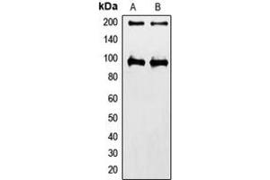 Western blot analysis of IGF1 Receptor expression in HeLa (A), MCF7 (B) whole cell lysates. (IGF1R antibody  (C-Term))