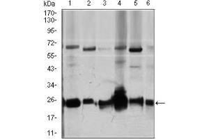 Western Blotting (WB) image for anti-rho GDP Dissociation Inhibitor (GDI) alpha (ARHGDIA) (AA 1-204) antibody (ABIN1844919) (ARHGDIA antibody  (AA 1-204))