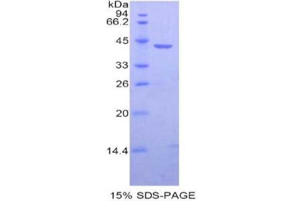 HIST1H2AB Protein