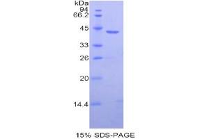 SDS-PAGE analysis of Human HIST1H2AB Protein. (HIST1H2AB Protein)