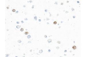 Immunocytochemistry (ICC) image for anti-Interleukin 9 (IL9) (AA 19-144) antibody (ABIN7795753) (Recombinant IL-9 antibody  (AA 19-144))
