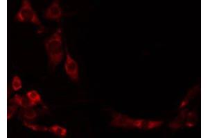 ABIN6274951 staining Hela by IF/ICC. (CHST1 antibody  (Internal Region))