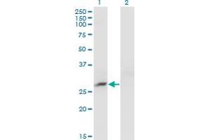 Western Blot analysis of CRYBB3 expression in transfected 293T cell line by CRYBB3 monoclonal antibody (M01), clone 4H6. (CRYBB3 antibody  (AA 112-211))