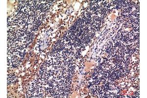 Immunohistochemistry (IHC) analysis of paraffin-embedded Human Lymph, antibody was diluted at 1:100. (ADAM10 antibody)