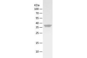ALAD Protein (AA 1-354) (His tag)