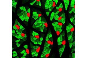 Immunofluorescent analysis of paraformaldehyde-fixed rat skeletal muscle using MYH1 (, red ) and MYH7 (ABIN7075623, green ) at dilution of 1: 1000 (Slow Skeletal Myosin Heavy Chain antibody)