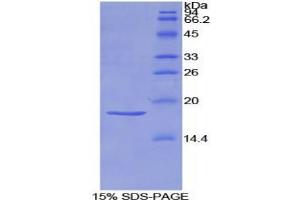 SDS-PAGE (SDS) image for Sema Domain, Immunoglobulin Domain (Ig), Short Basic Domain, Secreted, (Semaphorin) 3A (SEMA3A) protein (ABIN3011603)