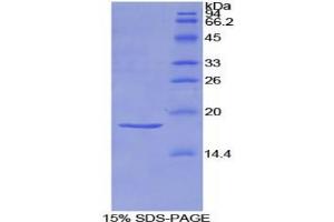 SDS-PAGE analysis of Rat Semaphorin 3A Protein. (SEMA3A Protein)