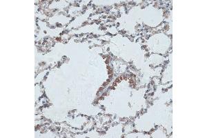 Immunohistochemistry of paraffin-embedded mouse lung using PMEP antibody (6555) at dilution of 1:100 (40x lens). (PMEPA1 antibody  (AA 173-252))