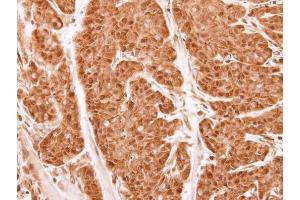IHC-P Image Immunohistochemical analysis of paraffin-embedded CA922 xenograft, using Proteasome 20S alpha 2, antibody at 1:500 dilution. (PSMA2 antibody  (Center))