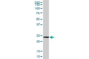 MAGEA8 MaxPab rabbit polyclonal antibody. (MAGEA8 antibody  (AA 1-318))