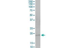 HSPC159 MaxPab polyclonal antibody. (GRP antibody  (AA 1-172))
