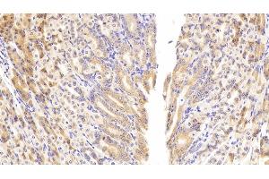 Immunohistochemistry (IHC) image for anti-phosphoenolpyruvate Carboxykinase 1 (Soluble) (PCK1) (AA 312-563) antibody (ABIN7432913)