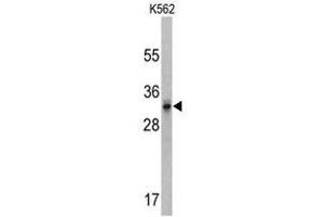 Image no. 1 for anti-Calcium Channel, Voltage-Dependent, gamma Subunit 5 (CACNG5) (C-Term) antibody (ABIN452794)