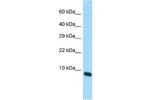 Host: Rabbit Target Name: MIR22HG Sample Type: Fetal Brain lysates Antibody Dilution: 1. (MIR22HG antibody  (C-Term))