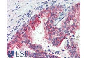ABIN5539753 (3µg/ml) staining of paraffin embedded Human Prostate. (ROR1 antibody  (C-Term))