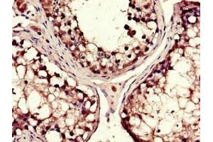 Immunohistochemistry of paraffin-embedded human testis tissue using ABIN7149312 at dilution of 1:100 (DYNC1H1 antibody  (AA 12-66))